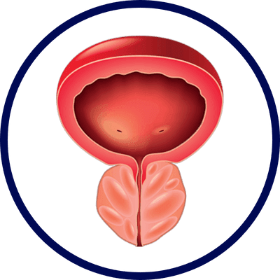 Passo 3 do tratamento com ZenProst