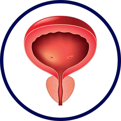 Passo 4 do tratamento com ZenProst